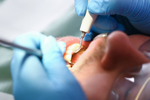 Best Emergency Dental Care for Trauma or Injury in Holly, MI