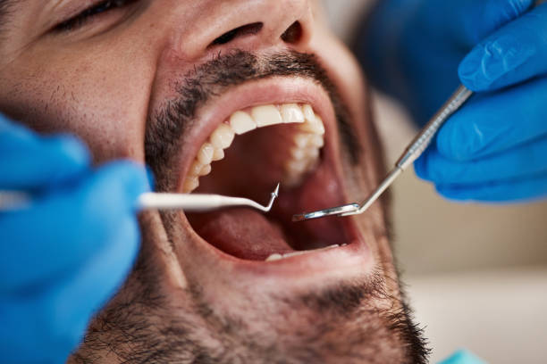 Best Emergency Tooth Extraction in Holly, MI