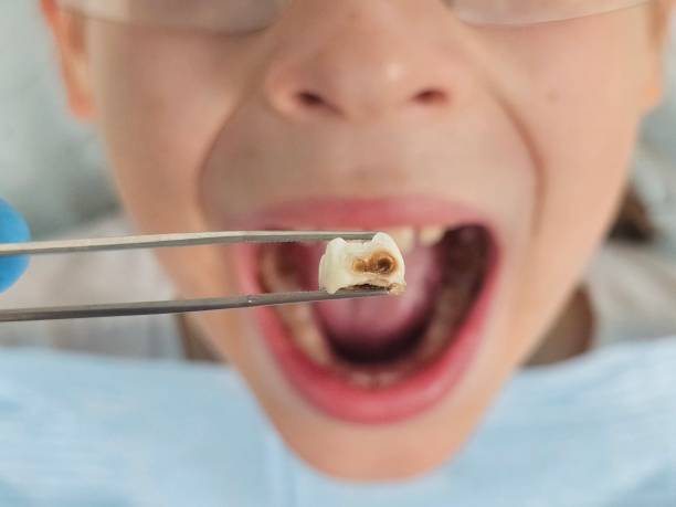 Best Pediatric Emergency Dentist in Holly, MI